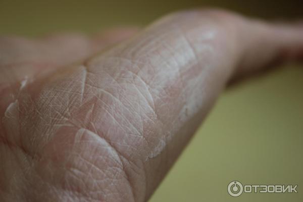 Крем-барьер от загара, веснушек и пигментации Floresan SPF 30 фото