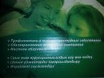 Облучатель ультрафиолетовый кварцевый "Солнышко" фото