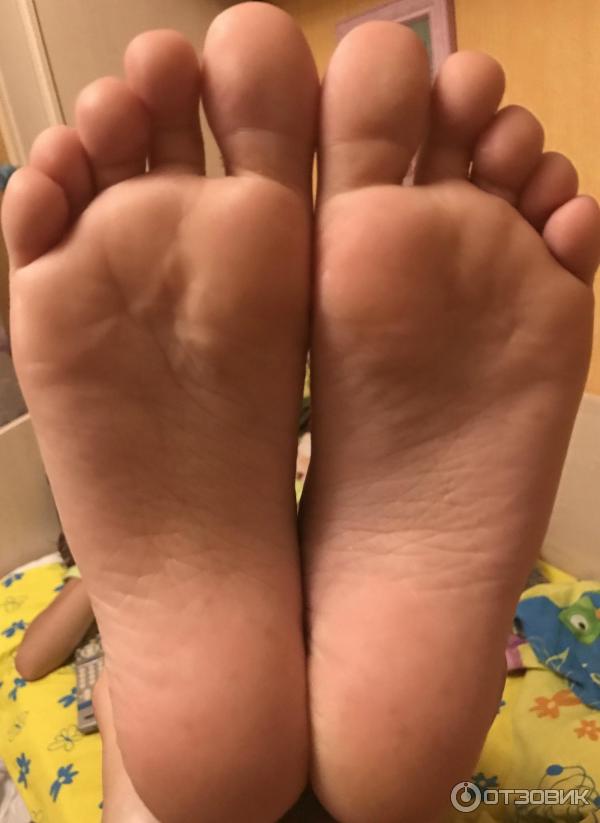 Лосьон Овадрил фото