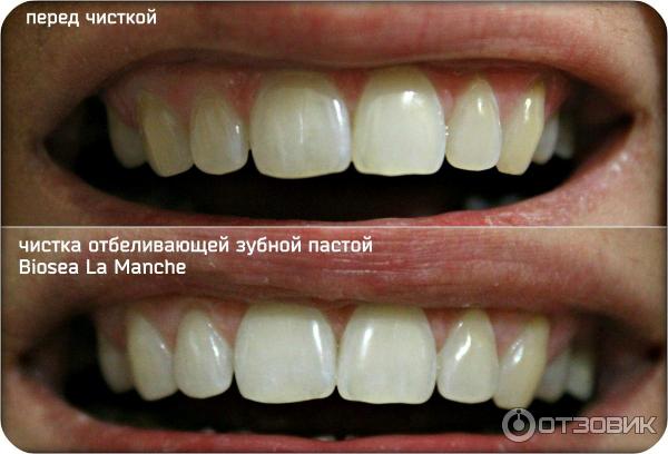 Отбеливающая зубная паста Biosea La Manche