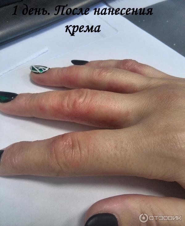 Крем для лица с гиалуроновой кислотой Фармтек Skin-Activ фото