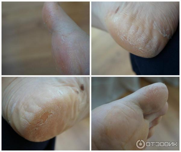 Пилинг для ног Holika Holika Baby Silky Foot One Shot Peeling фото