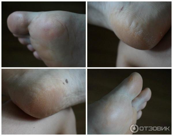 Пилинг для ног Holika Holika Baby Silky Foot One Shot Peeling фото