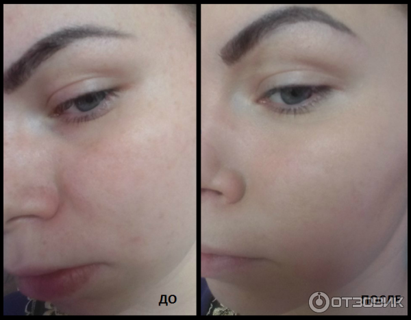 Тонирующий крем Avon Nutra Effects BB Совершенство SPF 15 фото