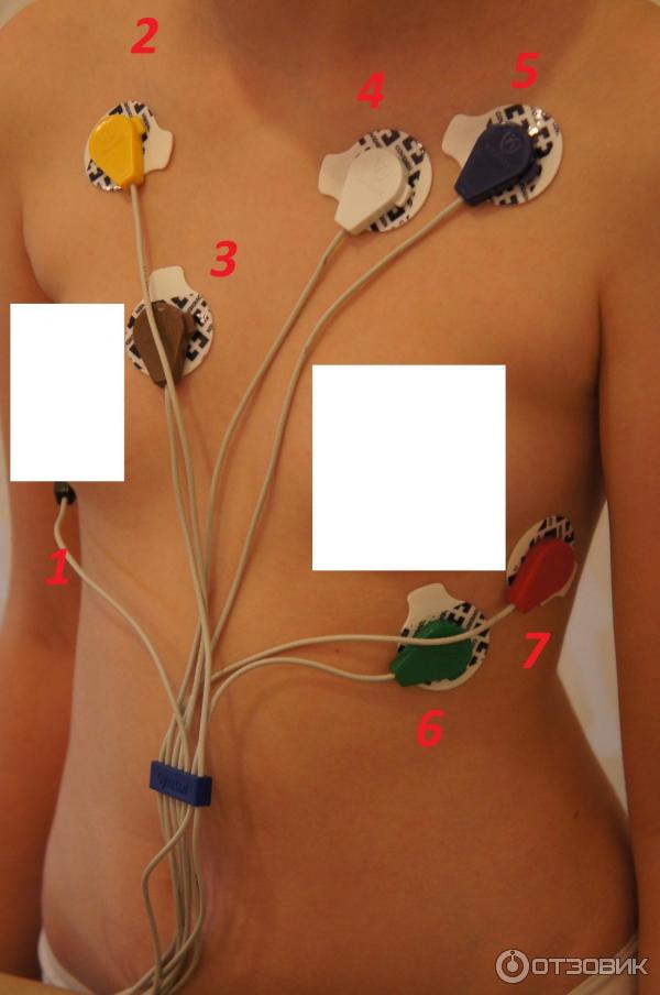 Как устанавливают холтер женщине на сердце фото Отзыв о Суточный (Холтеровский) мониторинг ЭКГ Суточное мониторирование по Холте