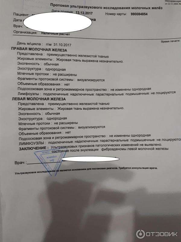 Фиброаденома молочной железы — причины, симптомы, удаление в НКЦ№2 (ЦКБ РАН)